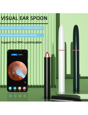 Intelligent visual ear spoon